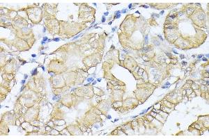 Immunohistochemistry of paraffin-embedded Human stomach using SPTAN1 Polyclonal Antibody at dilution of 1:100 (40x lens). (SPTAN1 抗体)