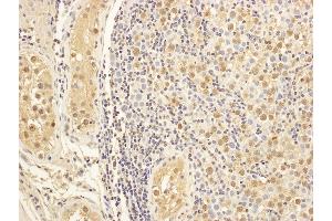 anti-Microtubule-Associated Protein 1S (MAP1S) (AA 475-525) antibody