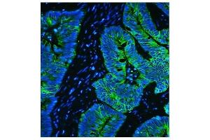 anti-Keratin 8 (KRT8) (AA 107-325) antibody