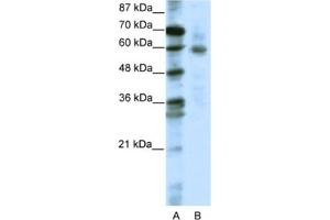 Western Blotting (WB) image for anti-Forkhead Box O1 (FOXO1) antibody (ABIN2461644) (FOXO1 抗体)