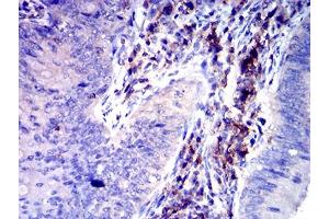 Immunohistochemistry (IHC) image for anti-SLAM Family Member 6 (SLAMF6) (AA 22-226) antibody (ABIN7193226)