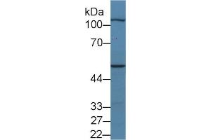 Western Blotting (WB) image for anti-Myopalladin (MYPN) (AA 945-1320) antibody (ABIN7436342)