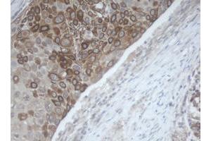 Image no. 1 for anti-Melanoma Antigen Family B, 1 (MAGEB1) antibody (ABIN1499266) (MAGEB1 抗体)