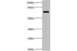 Western blot All lanes: Cartilage oligomeric matrix protein antibody at 4 μg/mL + Mouse skeletal muscle tissue Secondary Goat polyclonal to rabbit IgG at 1/10000 dilution Predicted band size: 83, 78 kDa Observed band size: 83 kDa (COMP 抗体  (AA 20-160))