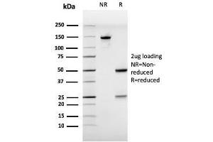 SDS-PAGE Analysis Purified Estrogen Receptor alpha Mouse Monoclonal Antibody (ESR1/3557). (Estrogen Receptor alpha 抗体  (AA 129-312))