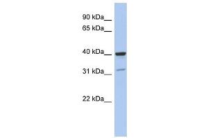Thrombopoietin antibody used at 1 ug/ml to detect target protein. (Thrombopoietin 抗体)