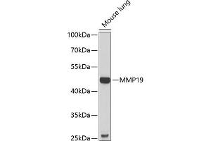 Western blot analysis of extracts of mouse lung, using MMP19 antibody (ABIN6132357, ABIN6143908, ABIN6143909 and ABIN6222356) at 1:1000 dilution. (MMP19 抗体  (AA 209-508))