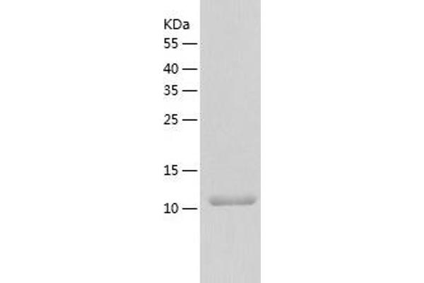 SRA1 Protein (AA 90-236) (His tag)