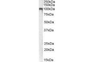 Image no. 1 for anti-Glutamate Receptor, Metabotropic 7 (GRM7) (Internal Region) antibody (ABIN375137) (GRM7 抗体  (Internal Region))