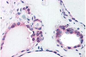 Human Thyroid (formalin-fixed, paraffin-embedded) stained with COPS2 antibody ABIN351473 at 3. (COPS2 抗体  (AA 439-451))