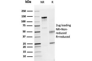 SDS-PAGE Analysis Purified Dystrophin Monospecific Mouse Monoclonal Antibody (DMD/3241). (Dystrophin 抗体  (AA 114-263))