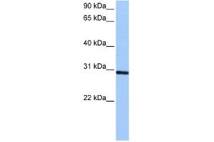 ASB11 antibody used at 0. (ASB11 抗体  (C-Term))