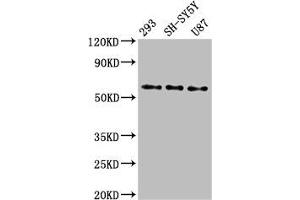 Western Blotting (WB) image for anti-Solute Carrier Family 11 (Proton-Coupled Divalent Metal Ion Transporters), Member 2 (SLC11A2) (AA 1-69) antibody (ABIN7161093)