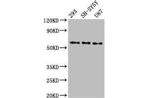 Western Blot Positive WB detected in: 293 whole cell lysate, SH-SY5Y whole cell lysate, U87 whole cell lysate All lanes: SLC11A2 antibody at 3 μg/mL Secondary Goat polyclonal to rabbit IgG at 1/50000 dilution Predicted band size: 63, 62, 65, 66 kDa Observed band size: 63 kDa (SLC11A2 抗体  (AA 1-69))