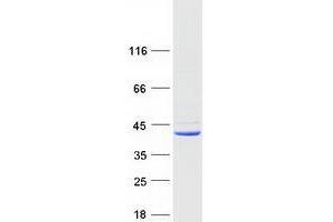 Western Blotting (WB) image for Transmembrane Protein 173 (TMEM173) protein (Myc-DYKDDDDK Tag) (ABIN2733879)