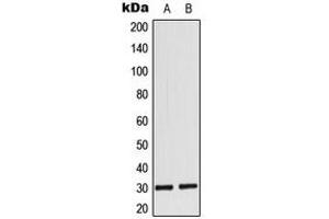 Western blot analysis of MYF6 expression in MCF7 (A), rat heart (B) whole cell lysates. (MYF6 抗体  (Center))