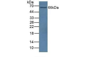 Detection of NOS1AP in Mouse Brain Tissue using Polyclonal Antibody to Nitric Oxide Synthase 1 Adaptor Protein (NOS1AP) (NOS1AP 抗体  (AA 285-506))