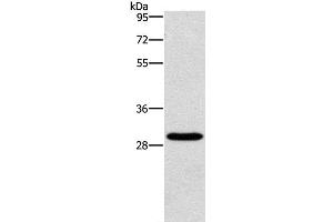 Western Blot analysis of Hela cell using BCL10 Polyclonal Antibody at dilution of 1:950 (BCL10 抗体)