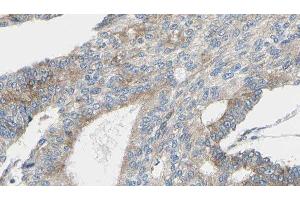 Immunohistochemistry (IHC) image for anti-Peroxiredoxin 2 (PRDX2) (C-Term) antibody (ABIN6264411)