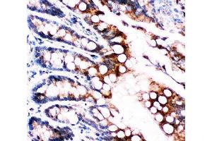 IHC-P: FABP5 antibody testing of rat intestine tissue (FABP5 抗体  (AA 10-23))