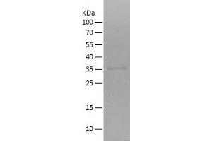 Western Blotting (WB) image for Met Proto-Oncogene (MET) (AA 956-1080) protein (His-IF2DI Tag) (ABIN7123920) (c-MET Protein (AA 956-1080) (His-IF2DI Tag))