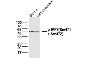 Lane 1: Mouse uterus lysates, Lane 2: Mouse large intestine lysates probed with IRF7 (Ser471 + Ser472) Polyclonal Antibody, unconjugated  at 1:300 overnight at 4°C followed by a conjugated secondary antibody for 60 minutes at 37°C. (IRF7 抗体  (pSer471, pSer472))