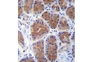 Immunohistochemistry analysis in human stomach tissue (formalin-fixed, paraffin-embedded) using Mid1-interacting protein 1  Antibody  (N-term),  followed by peroxidase conjugation of the secondary antibody and DAB staining. (m1ip1 抗体  (N-Term))