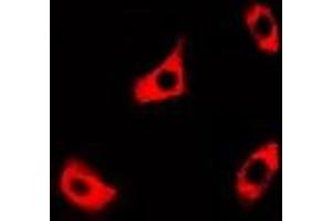 Immunofluorescent analysis of PPOX staining in A549 cells. (PPOX 抗体)
