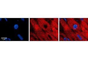 Rabbit Anti-EIF2B2 Antibody Catalog Number: ARP65664_P050 Formalin Fixed Paraffin Embedded Tissue: Human heart Tissue Observed Staining: Cytoplasmic near intercalated discs Primary Antibody Concentration: 1:100 Other Working Concentrations: N/A Secondary Antibody: Donkey anti-Rabbit-Cy3 Secondary Antibody Concentration: 1:200 Magnification: 20X Exposure Time: 0.