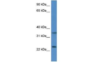 Mouse Thymus; WB Suggested Anti-Cyb5r1 Antibody. (CYB5R1 抗体  (N-Term))