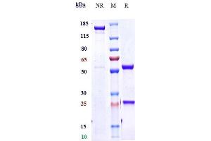 Anti-IL-4Ra / CD124 Reference Antibody (dupilumab) on SDS-PAGE under reducing (R) condition. (Recombinant IL-4RA (Dupilumab Biosimilar) 抗体)