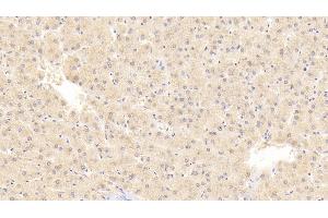 Detection of PRAME in Human Liver Tissue using Polyclonal Antibody to Preferentially Expressed Antigen In Melanoma (PRAME)