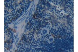 DAB staining on IHC-P; Samples: Mouse Spleen Tissue (BOC 抗体  (AA 668-866))