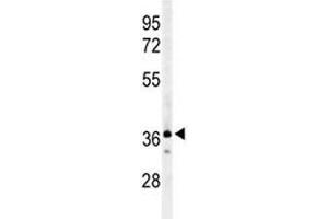 Western blot analysis of CCR1 antibody and 293 lysate. (CCR1 抗体  (AA 1-30))