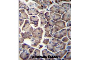 WDR12 Antibody (Center) (ABIN657000 and ABIN2846179) immunohistochemistry analysis in formalin fixed and paraffin embedded human pancreas tissue followed by peroxidase conjugation of the secondary antibody and DAB staining. (WDR12 抗体  (AA 210-239))