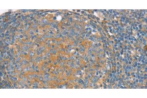 Immunohistochemistry of paraffin-embedded Human tonsil using SNX3 Polyclonal Antibody at dilution of 1:30 (Sorting Nexin 3 抗体)