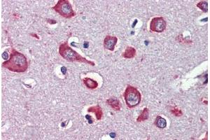 Human Brain, Cortex (formalin-fixed, paraffin-embedded) stained with CHRNA7 antibody ABIN462402 followed by biotinylated secondary antibody, alkaline phosphatase-streptavidin and chromogen. (CHRNA7 抗体)