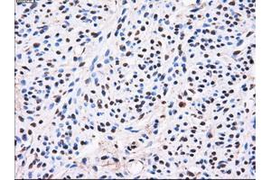 Immunohistochemical staining of paraffin-embedded liver tissue using anti-AKR1A1mouse monoclonal antibody. (AKR1A1 抗体)