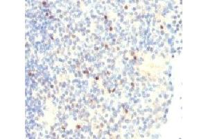 IHC analysis of FOXP3 antibody and human tonsil tissue. (FOXP3 抗体  (N-Term))