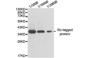 Western blot analysis of over-expressed His-tagged protein in 293T cell using His-tag antibody.