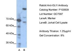 WB Suggested Anti-GLI1  Antibody Titration: 1. (GLI1 抗体  (N-Term))