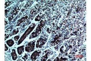 Immunohistochemistry (IHC) image for anti-Phospholipase A2, Group IVA (Cytosolic, Calcium-Dependent) (PLA2G4A) (N-Term) antibody (ABIN3187717)