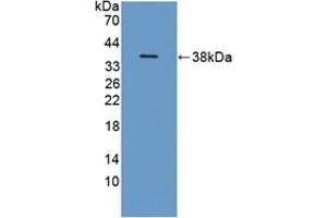 Detection of Recombinant ITIH1, Human using Polyclonal Antibody to Inter Alpha-Globulin Inhibitor H1 (ITIH1) (ITIH1 抗体  (AA 507-819))