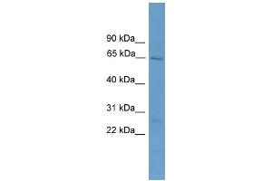 WB Suggested Anti-ACOT11 Antibody Titration: 0. (ACOT11 抗体  (Middle Region))