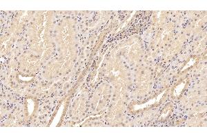 Detection of TNC in Human Kidney Tissue using Monoclonal Antibody to Tenascin C (TNC) (TNC 抗体  (AA 49-181))