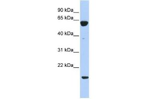 PTP4A3 antibody used at 1 ug/ml to detect target protein. (PTP4A3 抗体  (Middle Region))