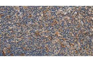 Immunohistochemistry of paraffin-embedded Human tonsil using GGT1 Polyclonal Antibody at dilution of 1:40 (GGT1 抗体)