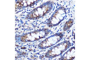 Immunohistochemistry (IHC) image for anti-Signal Transducer and Activator of Transcription 4 (STAT4) (AA 600-700) antibody (ABIN1682909)
