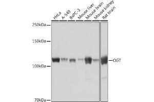Western blot analysis of extracts of various cell lines, using OGT Rabbit mAb (ABIN7269074) at 1:1000 dilution. (OGT 抗体)