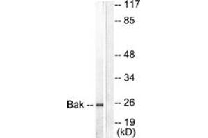 Western blot analysis of extracts from 293 cells, using Bak Antibody. (BAK1 抗体  (AA 1-50))